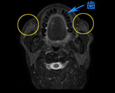 MRI顔の縦スライス画像