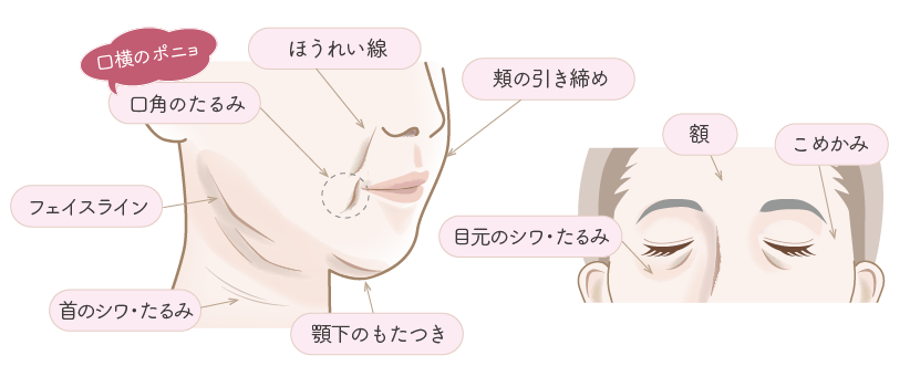 たるみ・シワのお悩み部位
