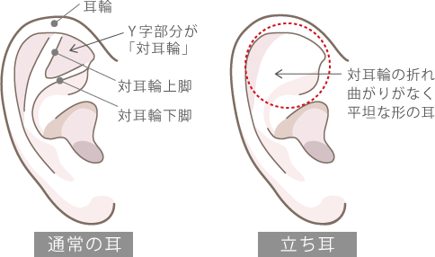 通常の耳の形と立ち耳の比較